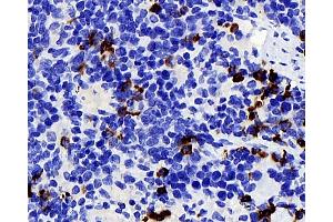 Immunohistochemistry analysis of parafffin-embedded mouse spleen using P2RX3 Polyclonal Antibody at dilution of 1:400. (P2RX3 antibody)