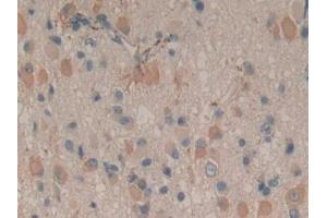 Immunohistochemistry (IHC) image for anti-Peptidylprolyl Isomerase D (PPID) (AA 7-206) antibody (ABIN7440194)