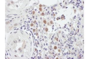 Immunohistochemistry (IHC) image for anti-MutS Homolog 6 (E. Coli) (MSH6) (C-Term) antibody (ABIN7454511)