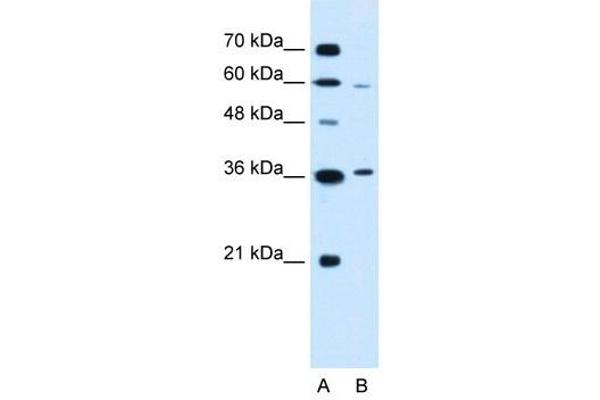 PARL antibody  (N-Term)