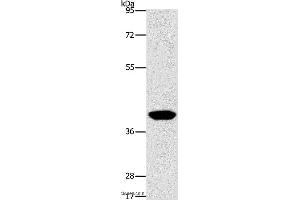 Western blot analysis of Human lymphoma tissue, using AGXT2L2 Polyclonal Antibody at dilution of 1:500 (AGXT2L2 antibody)
