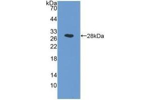 Detection of Recombinant NAAA, Human using Polyclonal Antibody to N-Acylethanolamine Acid Amidase (NAAA) (NAAA antibody  (AA 112-359))