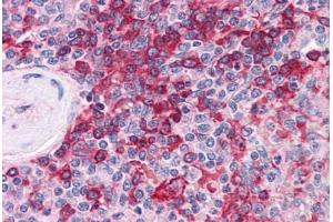 Immunohistochemistry (Formalin-fixed Paraffin-embedded Sections) (IHC (fp)) image for anti-Membrane Protein, Palmitoylated 5 (MAGUK P55 Subfamily Member 5) (MPP5) (AA 124-187) antibody (ABIN604916)