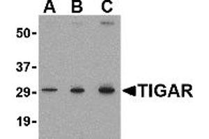 Western Blotting (WB) image for anti-TP53 induced glycolysis regulatory phosphatase (TIGAR) (Middle Region 2) antibody (ABIN1031205) (TIGAR antibody  (Middle Region 2))