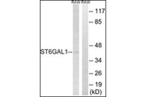 Western blot analysis of extracts from RAW264. (ST6GAL1 antibody  (Internal Region))