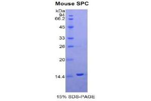 SDS-PAGE (SDS) image for Surfactant Protein C (SFTPC) (AA 94-193) protein (His tag) (ABIN2122156)
