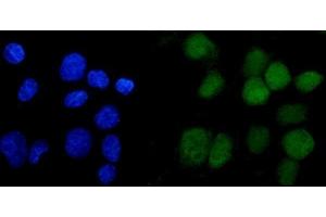 anti-Anaphase Promoting Complex Subunit 2 (ANAPC2) (AA 51-272) antibody