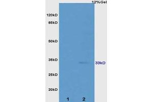 L1 rat kidney lysates L2 rat colon lysates probed with Anti ATP1b2/Na+K+ATPase Polyclonal Antibody, Unconjugated (ABIN738426) at 1:200 overnight at 4 °C. (Atp1b2/Na+K+Atpase (AA 201-290) antibody)