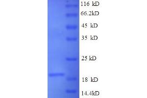 SDS-PAGE (SDS) image for Sjogren Syndrome Antigen B (SSB) (AA 1-172), (full length) protein (His-SUMO Tag) (ABIN5711479) (SSB Protein (AA 1-172, full length) (His-SUMO Tag))