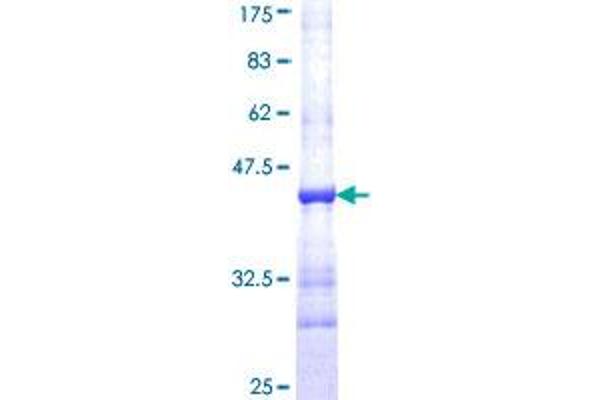 BLVRB Protein (AA 107-206) (GST tag)