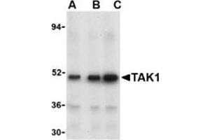 Western blot analysis of TAK1 in Rat thymus cell lysate with this product at (A) 1, (B) 2, and (C) 4 μg/ml. (MAP3K7 antibody  (N-Term))