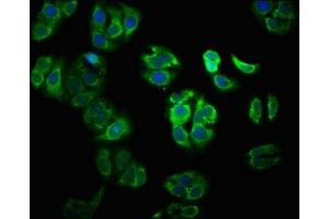 Immunofluorescence staining of HepG2 cells with ABIN7175958 at 1:100, counter-stained with DAPI. (YY1AP1 antibody  (AA 335-466))