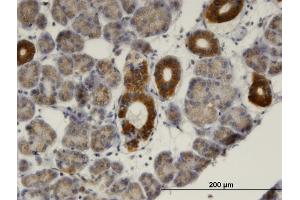Immunoperoxidase of monoclonal antibody to MVK on formalin-fixed paraffin-embedded human salivary gland. (MVK antibody  (AA 297-396))