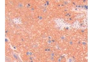 Detection of SPTAN1 in Rat Spinal cord Tissue using Polyclonal Antibody to Alpha-Fodrin (SPTAN1) (SPTAN1 antibody  (AA 2071-2269))