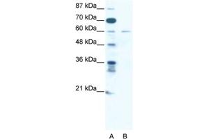 Western Blotting (WB) image for anti-Zinc Finger Protein 92 (ZNF92) antibody (ABIN2461312) (ZNF92 antibody)