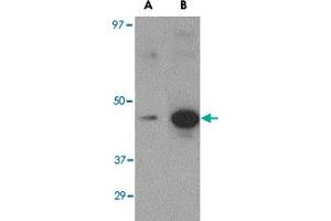 Western blot analysis of (A) 5 ng and (B) 25 ng of recombinant Hemagglutinin with Hemagglutinin monoclonal antibody, clone 1E6A7  at 1 ug/mL . (Hemagglutinin antibody  (Internal Region))