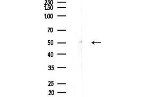 anti-Cytochrome P450 11B1/2 (N-Term) antibody