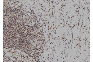 ABIN6279633 at 1/100 staining Human gastric tissue by IHC-P. (NOL9 antibody  (Internal Region))