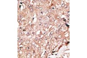 Image no. 2 for anti-Lysine (K)-Specific Demethylase 1A (KDM1A) (C-Term) antibody (ABIN356730)