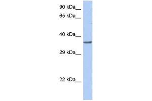 WB Suggested Anti-TFDP1 Antibody Titration:  0. (DP1 antibody  (Middle Region))
