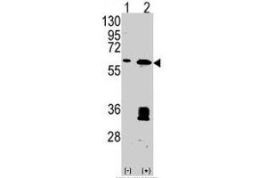 Western blot analysis of MDM2 (arrow) using MDM2 polyclonal antibody . (MDM2 antibody  (C-Term))