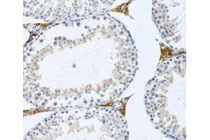 Immunohistochemistry of paraffin-embedded Mouse testis using FMOD Polyclonal Antibody at dilution of 1:100 (20x lens). (Fibromodulin antibody)