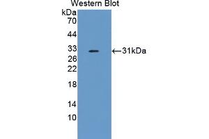 Detection of Recombinant CFI, Mouse using Polyclonal Antibody to Complement Factor I (CFI) (Complement Factor I antibody  (AA 358-603))