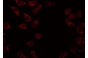 ABIN6276942 staining HeLa by IF/ICC. (CADM1 antibody  (Internal Region))