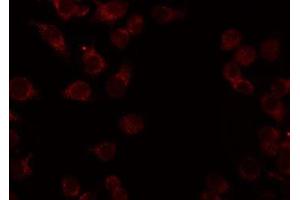 ABIN6276942 staining HeLa by IF/ICC. (CADM1 antibody  (Internal Region))