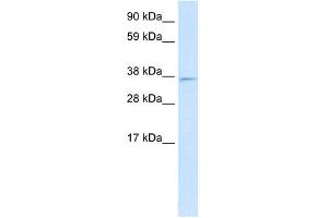 Western Blotting (WB) image for anti-MAX Interactor 1 (MXI1) (Middle Region) antibody (ABIN2777279)