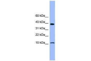 WB Suggested Anti-CSTB Antibody Titration: 0. (CSTB antibody  (N-Term))