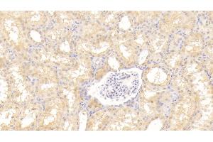 Detection of Tie1 in Human Kidney Tissue using Polyclonal Antibody to Tyrosine Kinase With Immunoglobulin Like And EGF Like Domains Protein 1 (Tie1) (TIE1 antibody  (AA 701-898))