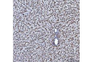 IHC analysis of hnRNP L/HNRNPL using anti-hnRNP L/HNRNPL antibody (ABIN7600130). (HNRNPL antibody  (AA 152-569))