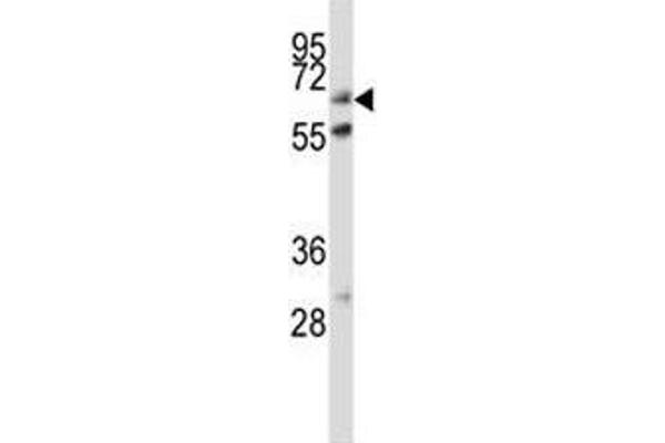 Alkaline Phosphatase antibody  (AA 282-309)