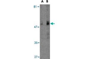 Western blot analysis of TBC1D10C in human spleen tissue lysate with TBC1D10C polyclonal antibody  at (A) 1 and (B) 2 ug/mL .