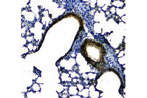 IHC analysis of Uteroglobin using anti-Uteroglobin antibody . (SCGB1A1 antibody  (AA 20-96))