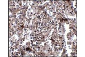Immunohistochemistry of KCTD15 in human spleen tissue with this product at 2. (KCTD15 antibody  (C-Term))