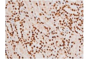 Immunohistochemistry (IHC) image for anti-REL proto-oncogene (c-Rel) (pSer503) antibody (ABIN6255382)