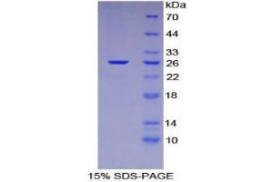 SDS-PAGE (SDS) image for Nucleoporin 133kDa (NUP133) (AA 36-240) protein (His tag) (ABIN2126140)