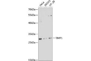 Western blot analysis of extracts of various cell lines, using TIMP1 antibody (ABIN6128284, ABIN6149176, ABIN6149177 and ABIN6218052) at 1:1000 dilution. (TIMP1 antibody  (AA 24-207))