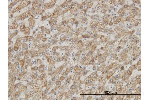 Immunoperoxidase of monoclonal antibody to DDX56 on formalin-fixed paraffin-embedded human liver. (DDX56 antibody  (AA 450-547))