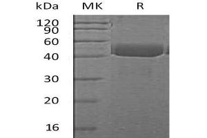 Western Blotting (WB) image for Cathepsin E (CTSE) (AA 60-397) protein (His tag) (ABIN7320713) (Cathepsin E Protein (CTSE) (AA 60-397) (His tag))