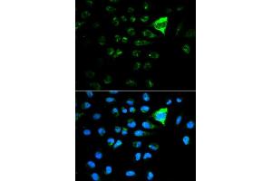 Immunofluorescence analysis of MCF7 cell using CDKN1A antibody. (p21 antibody  (AA 43-142))