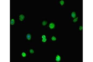Immunofluorescent analysis of HepG2 cells using ABIN7160194 at dilution of 1:100 and Alexa Fluor 488-congugated AffiniPure Goat Anti-Rabbit IgG(H+L) (MORC1 antibody  (AA 683-984))