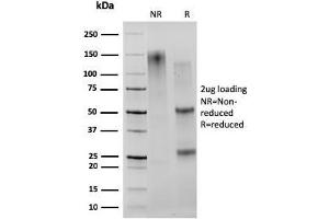 SDS-PAGE Analysis Purified CD27 Mouse Monoclonal Antibody (203.