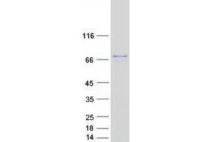Western Blotting (WB) image for NADH Dehydrogenase (Ubiquinone) Flavoprotein 3, 10kDa (NDUFV3) (Transcript Variant 1) protein (Myc-DYKDDDDK Tag) (ABIN2727046)