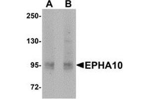 Western Blotting (WB) image for anti-EPH Receptor A10 (EPHA10) (N-Term) antibody (ABIN1031373) (EPH Receptor A10 antibody  (N-Term))