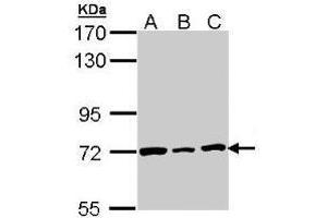 Western Blot: Lamin B2 antibody staining of H1299 (A), Hela (B), HepG2 (C) whole cell lysates (30 µg) at 1/3000 dilution, 7.
