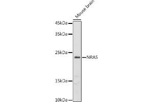 Western blot analysis of extracts of Mouse brain, using NRAS antibody (ABIN7267532) at 1:1000 dilution. (GTPase NRas antibody  (AA 1-189))