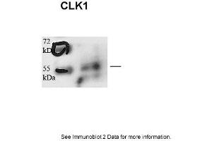 Sample type: human microvascular endothelial cells (25ug)Primary Dilution: 1:1000Secondary Antibody: Goat anti-Rabbit-HRPSecondary Dilution: 1:5000Image Submitted by: Andreas Eisenreich Charite Universitatsmedizin Berlin (CLK1 antibody  (N-Term))